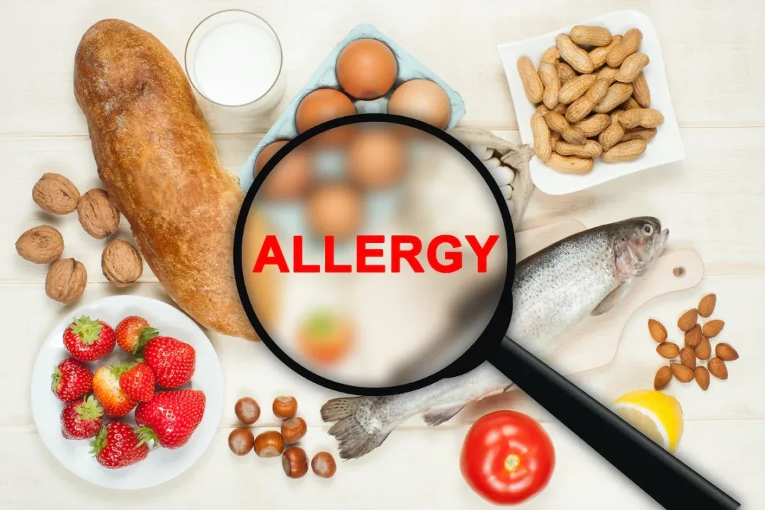 Allergy,Food,Concept.,Food,On,Wooden,Table